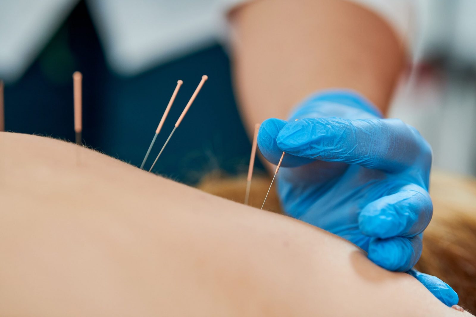 Tradiční čínská medicína